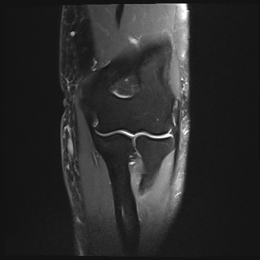 Click on the Serie image to view the images of Wieszt, Gnter